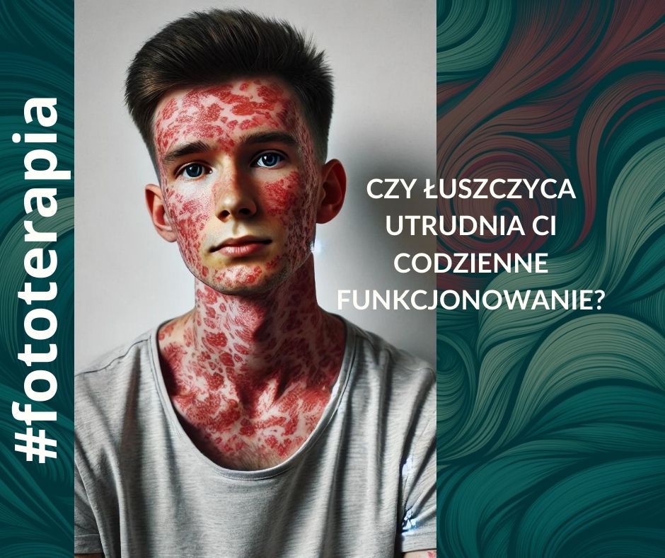 fototerapia, problemy skóry, łuszczyca, zabiegi które łagodzą problemy ze skórą